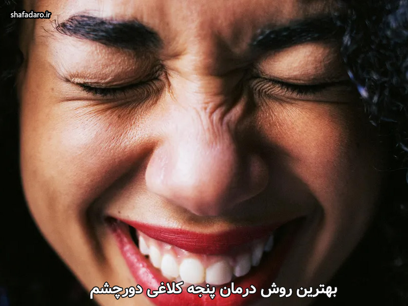 روش‌ های خانگی درمان پنجه کلاغی